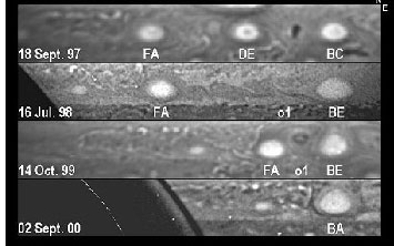 Colliding Storms on Jupiter